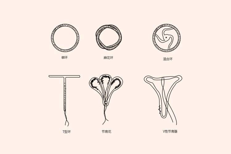 最新避孕環(huán)技術(shù)，探索生育控制的未來革新之路