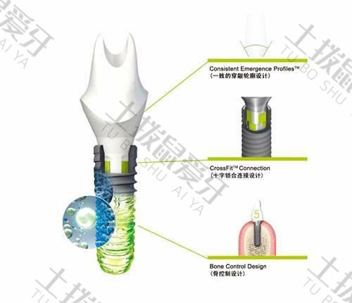 奧地利最新款植入體，醫(yī)療科技革新先鋒