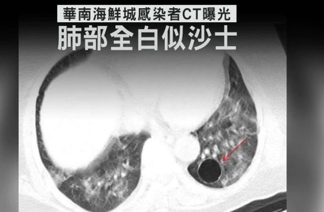 新加坡新冠肺炎全面應(yīng)對與最新進(jìn)展消息更新