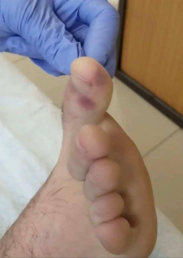 全國最新無癥狀感染者概況概覽